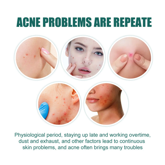 EELHOE Love Acne Patch Gentle Cleansing Acne Patch Fades Facial Acne Marks And Spots Facial Cleansing Care - 5 - CJ