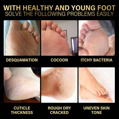 Jaysuing Lavender Exfoliating Foot Mask Exfoliating Foot Care Hydrating, Hydrating, Anti - chapping And Moisturizing Skin - 5 - CJ