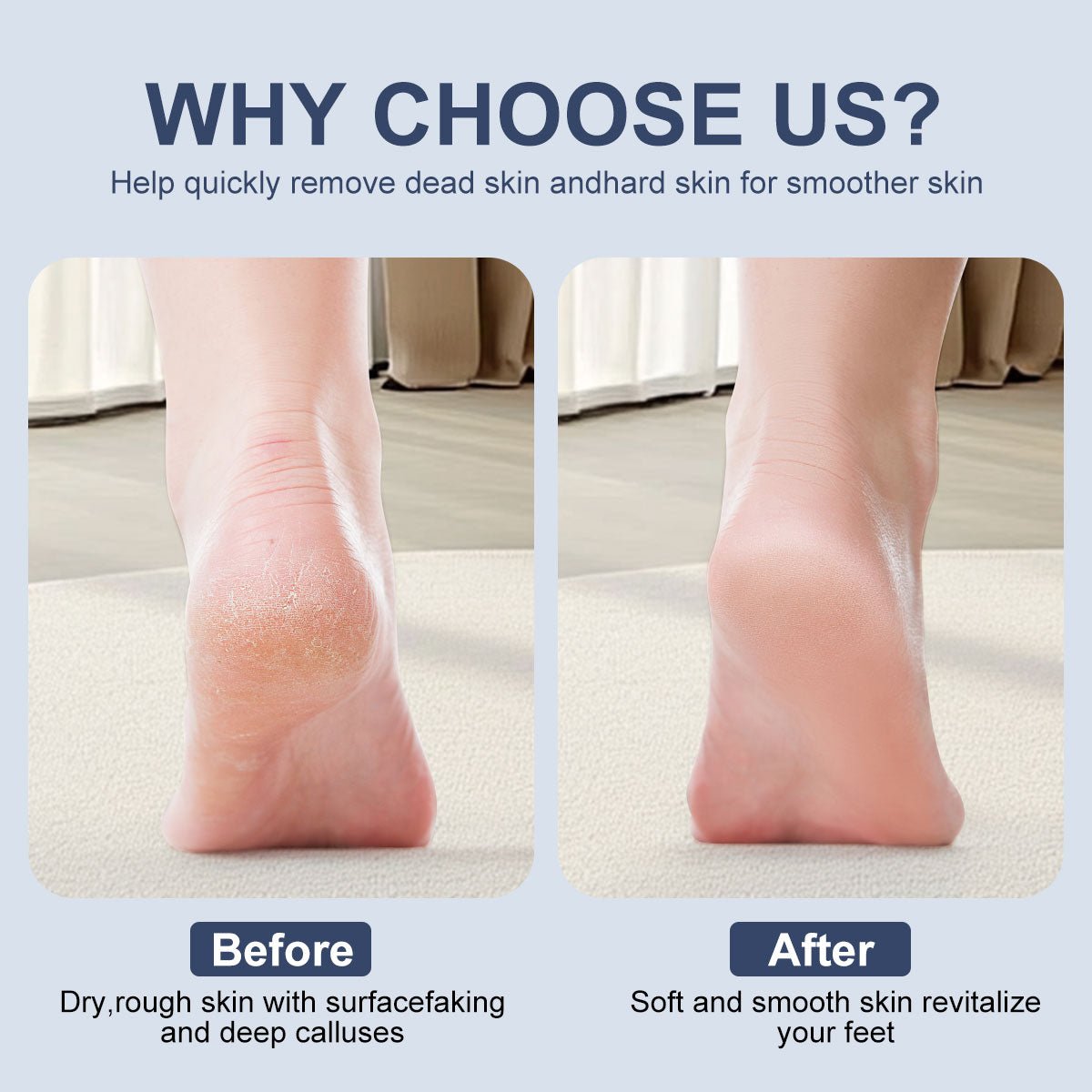 New Electric Callus Remover For Feet, Portable Rechargeable Foot Repair And Grinding Device With Digital Display, Heel Polisher File For Men Women Dry Callus Dead Skin - 5 - CJ