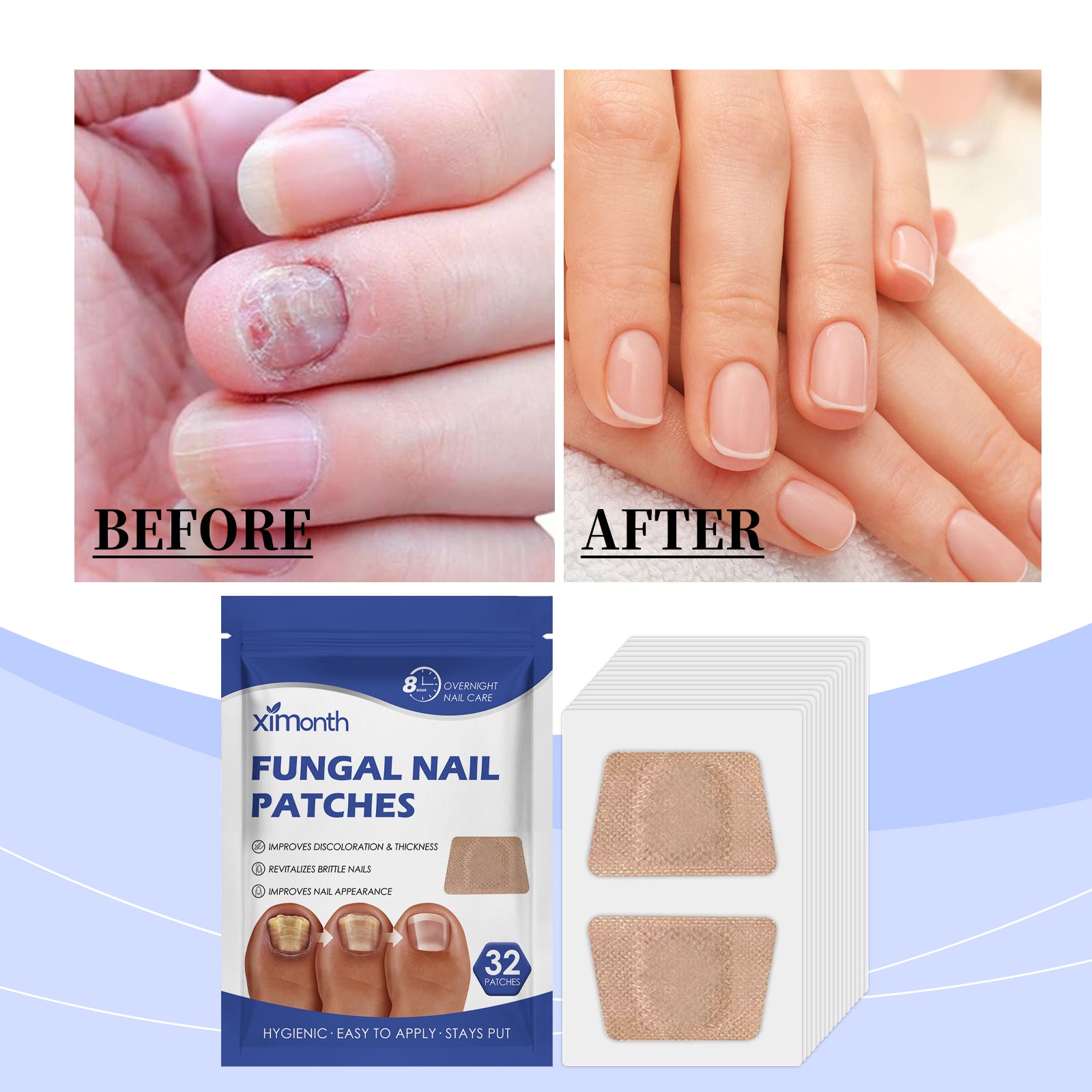 Ximonth Nail Care Patches Gently Repair Nails For Easy Daily Cleaning With Simple Care Patches - 5 - CJ