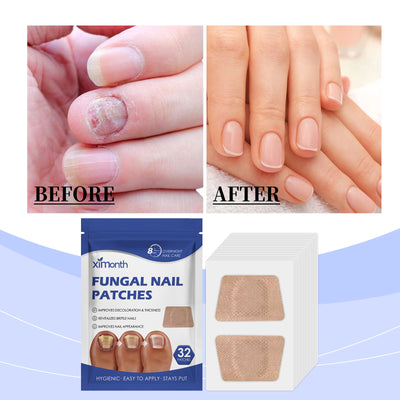 Ximonth Nail Care Patches Gently Repair Nails For Easy Daily Cleaning With Simple Care Patches - 5 - CJ
