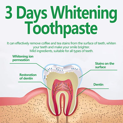 Toothpaste For Cleaning Oral Odor And Protecting Gums - 5 - CJ