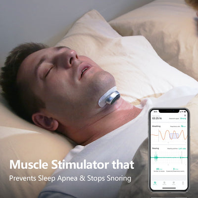 Smart Anti Snoring Device Electronic Muscle Stimulator Pro With 20pcs Conductive Strips - 5 - CJ