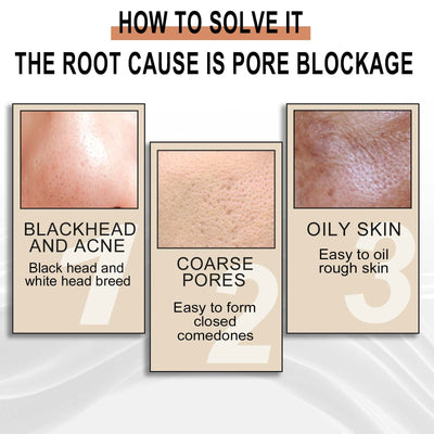 Jaysuing Lactobionic Acid Liquid Exfoliating Blackheads Shrinking Pores Cleansing Moisturizing Skin - 5 - CJ