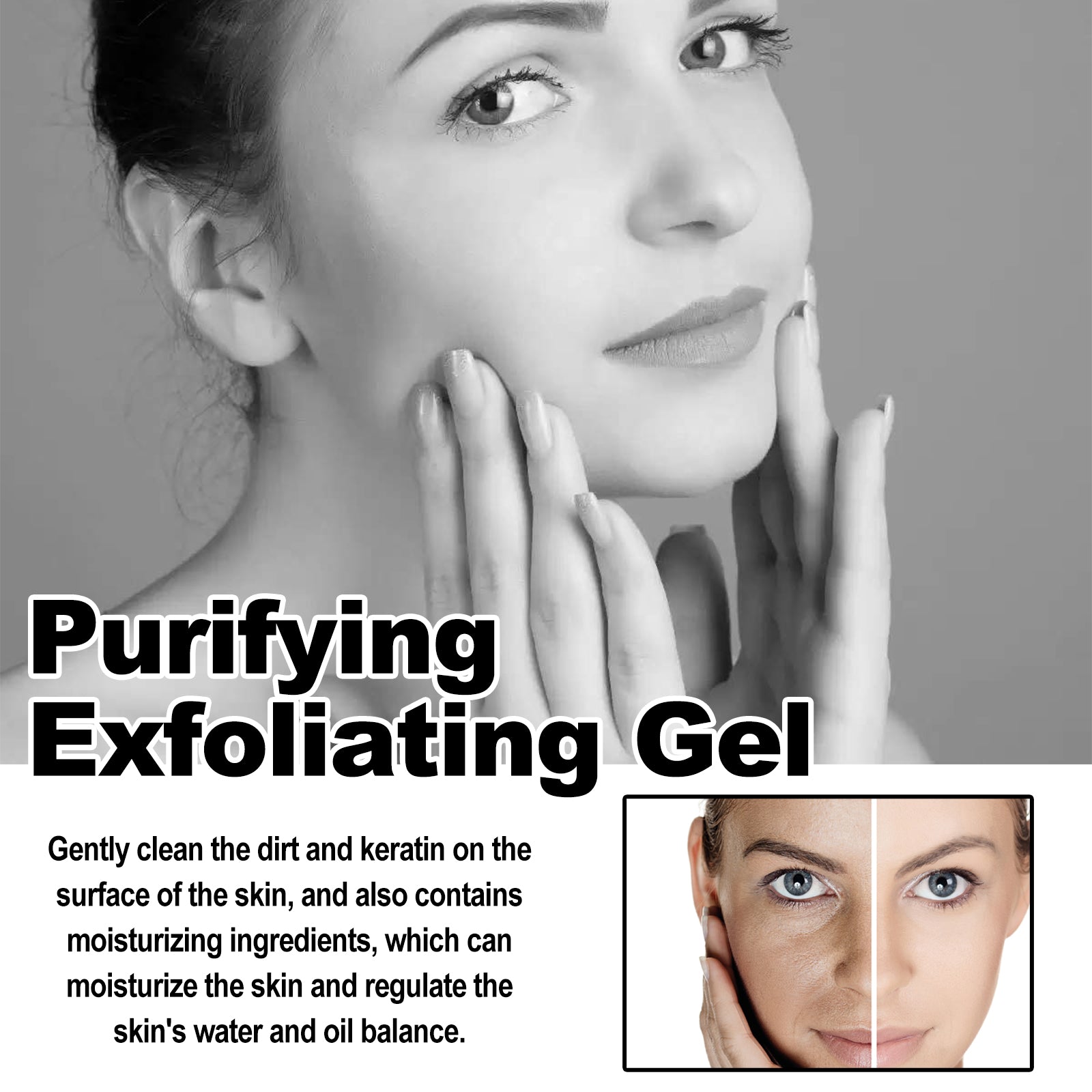 Deep Exfoliating Gel - 5 - CJ