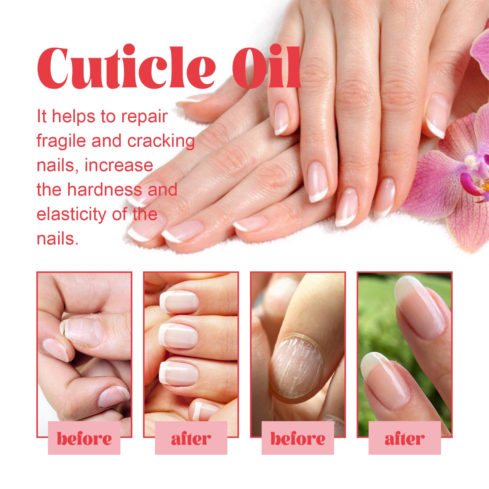 EELHOE Cuticle Oil, Manicure Bed Moisturizes And Brightens Nails Anti - Barb And Removes Dead Skin Fingeredge Oil - 5 - CJ
