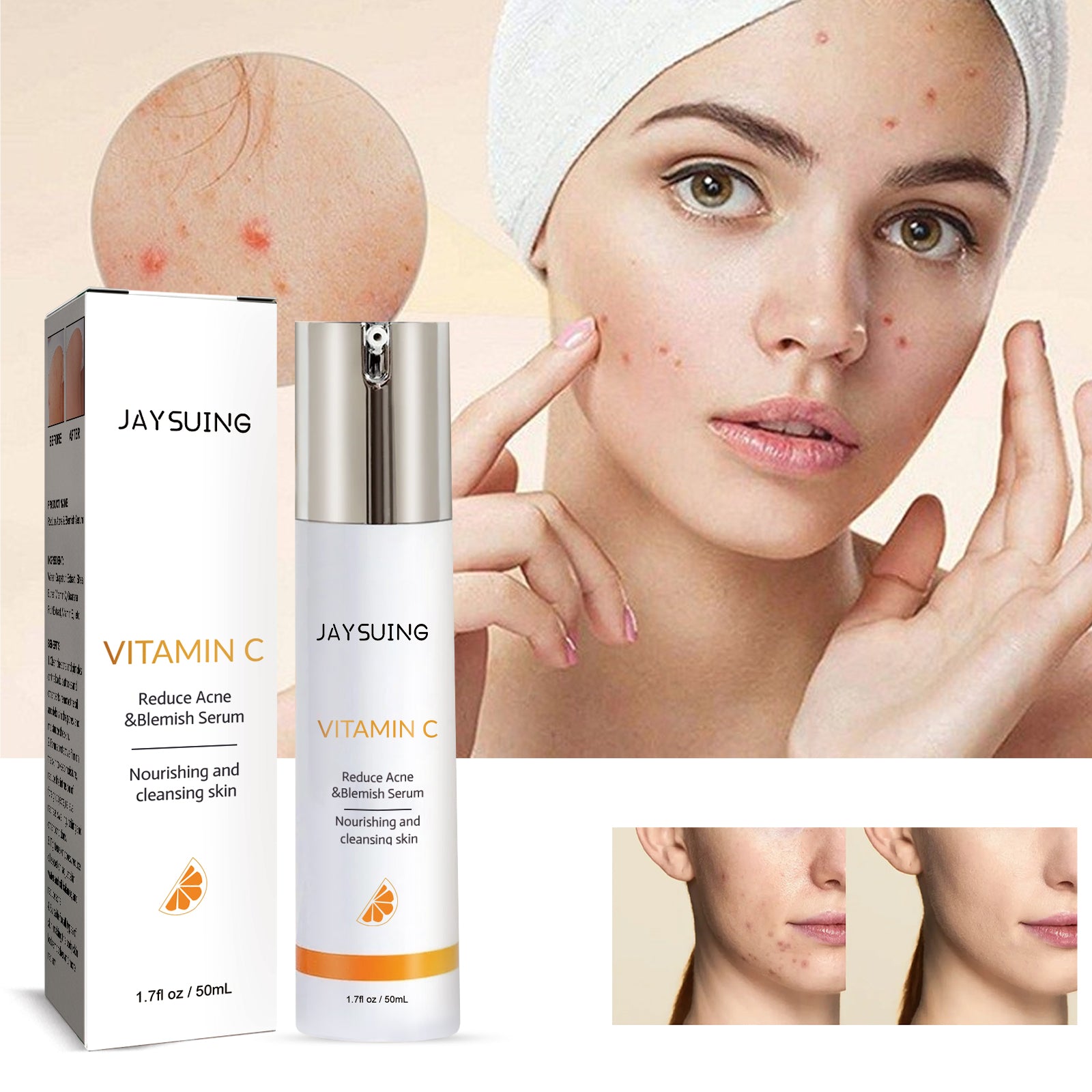 Jayusing Anti - Acne And Anti - Acne Serum, Reduce Acne And Acne Mark Moisturizing Skin Repair Serum - 5 - CJ