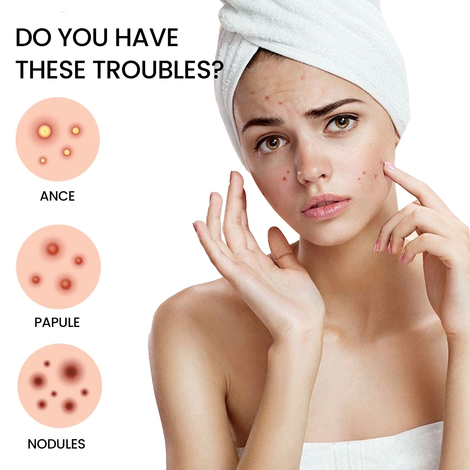 Jaysuing Star Colored Acne Stickers Repair Acne Pits & Marks Fade Acne Spots Blemishes Cover Acne Pimples - 5 - CJ