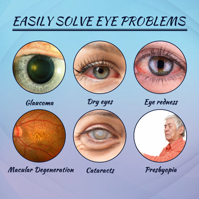 EELHOE Eye Drops Relieve Redness And Blurred Eyes Eye Fatigue Dryness Blurred Vision Moisturizing Eye Care Solution - 5 - CJ