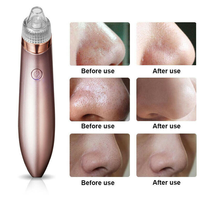 Electric Blackhead Vacuum Pore Cleaner Acne Pimple Remover Strong Suction Tool Electric Blackhead Remover Pore Vacuum Suction Diamond Dermabrasion Face Cleaner - 5 - CJ