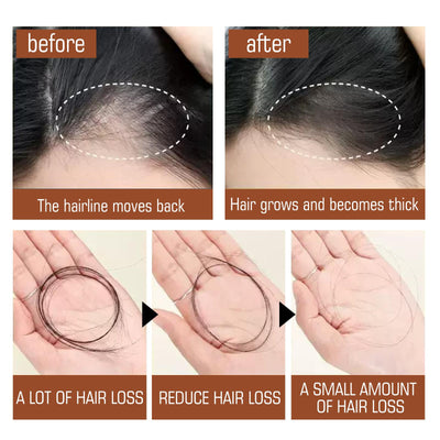 Batana Oil From Honduras - Get Fuller, Thicker, Healthier Hair - Great Gifts For Women  Men Conditioner Haircare Silky - Hair Nutrition - 5 - CJ