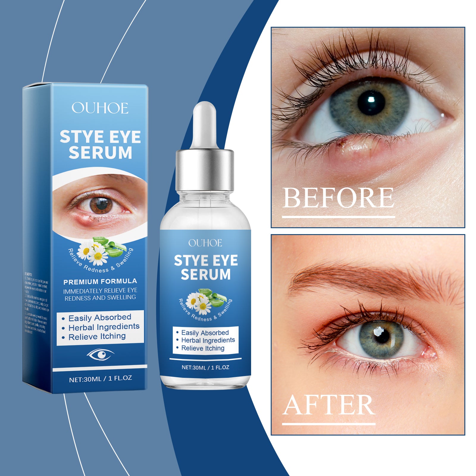 OUHOE Eye Care Drops Gently Nourish And Moisturize The Skin Around The Eyes. Portable Daily Eye Care Drops - 5 - CJ