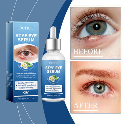 OUHOE Eye Care Drops Gently Nourish And Moisturize The Skin Around The Eyes. Portable Daily Eye Care Drops - 5 - CJ