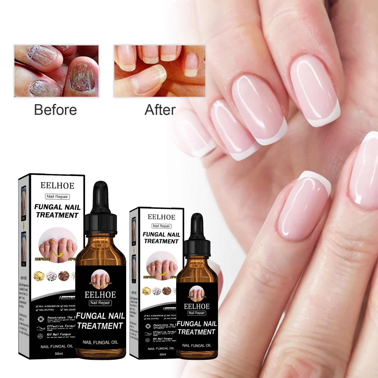 EELHOE Nail Repair Liquid Thickening, Brightening, Whitening, Repairing, Moisturizing, And Nourishing Nail Care Liquid - 5 - CJ