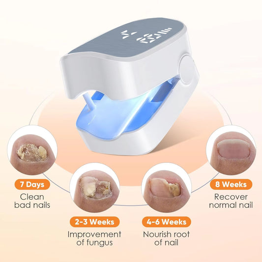 Nail Fungus Laser Treatment LED Light Device Effective Rechargeable Nail Fungus Remover Nail Fungus Cleaning Laser Device Repair Damaged Discolored Thick Fingernails - 5 - CJ