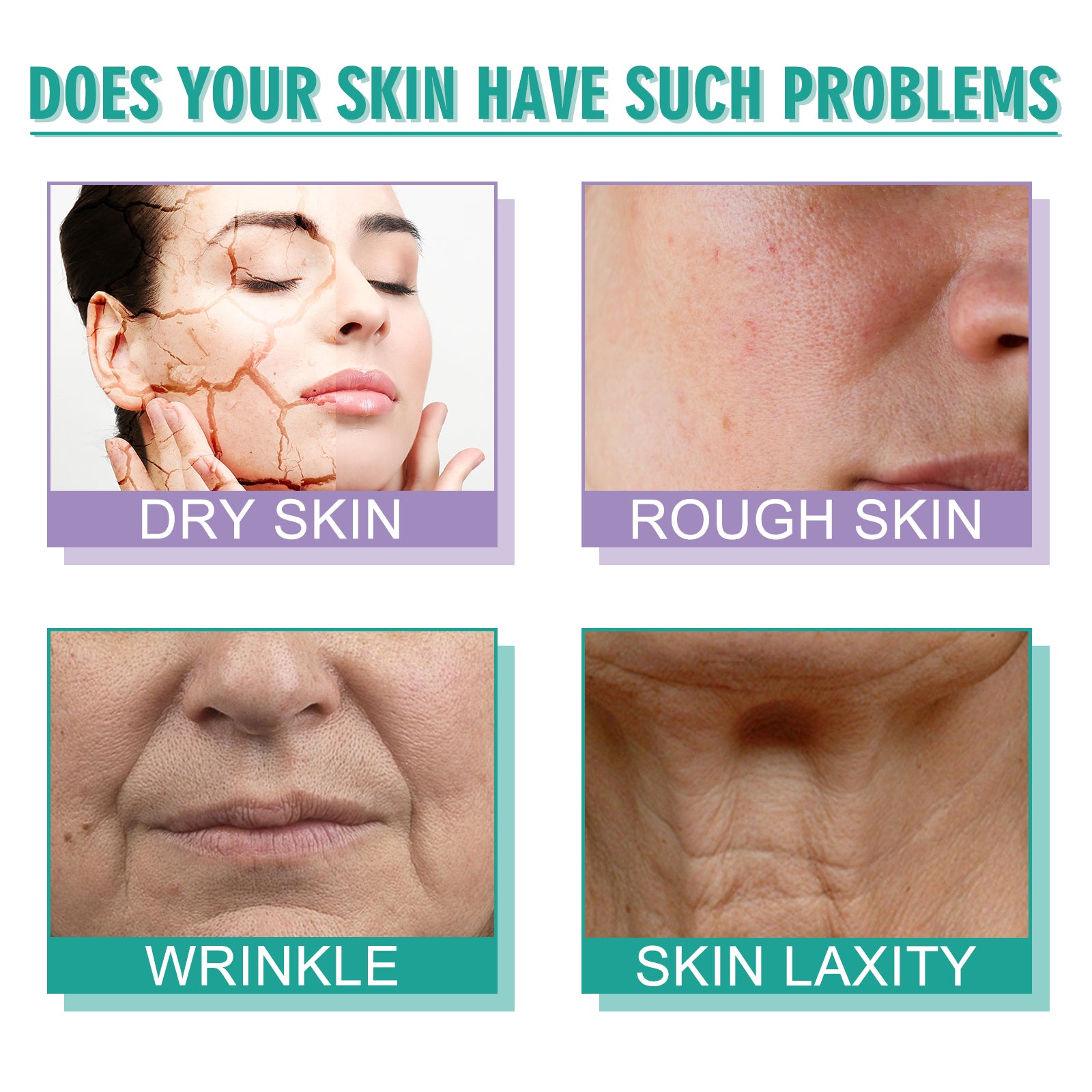 Hoygi Moisturizing Skin Care Cream Lighten Pigmentation Fine Lines Anti - Wrinkle Moisturizing Rejuvenation Whitening Firming Hydrating Cream - 5 - CJ