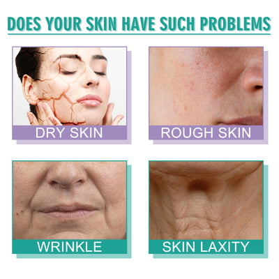 Hoygi Moisturizing Skin Care Cream Lighten Pigmentation Fine Lines Anti - Wrinkle Moisturizing Rejuvenation Whitening Firming Hydrating Cream - 5 - CJ