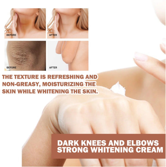 EELHOE Joint Darkening & Brightening Cream Moisturizing & Brightening Dark Skin Joint & Elbow Repair Cream - 5 - CJ