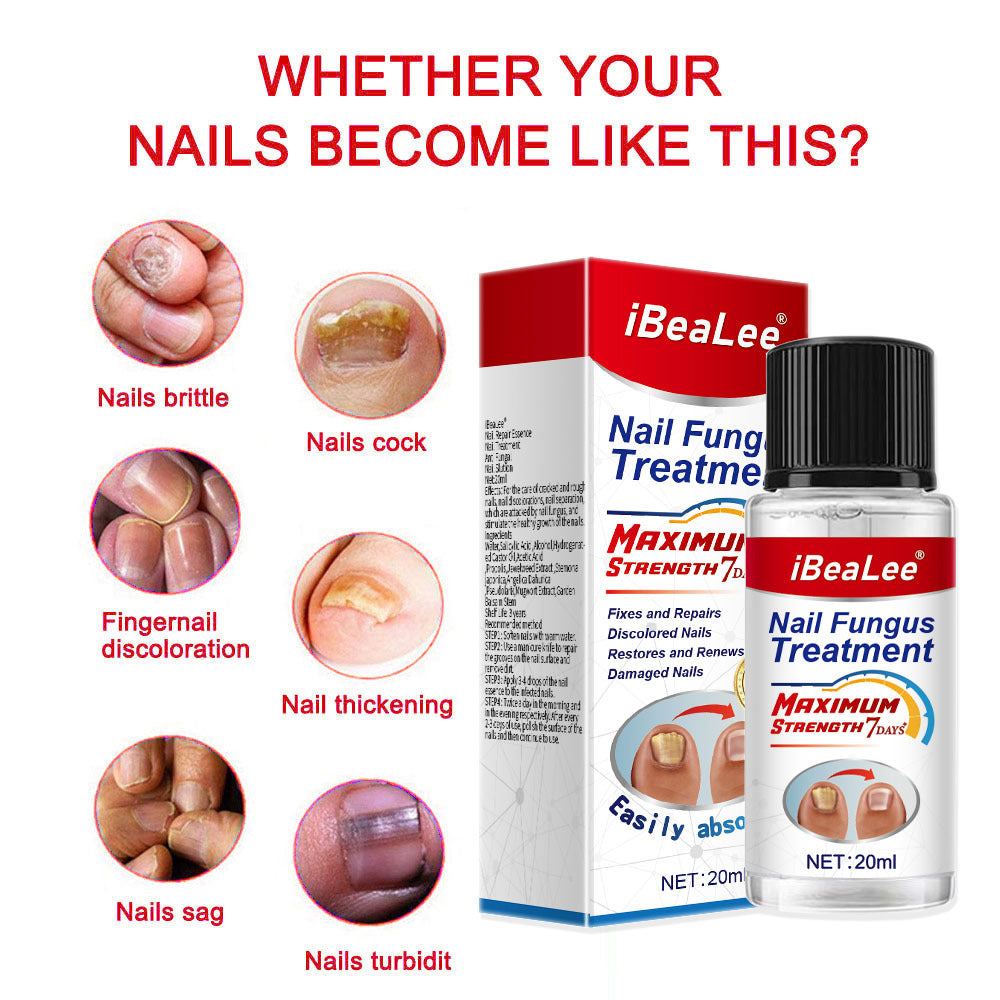 Thickening Of Special Bacteriostatic Liquid For Onychomycosis - 0 - CJ