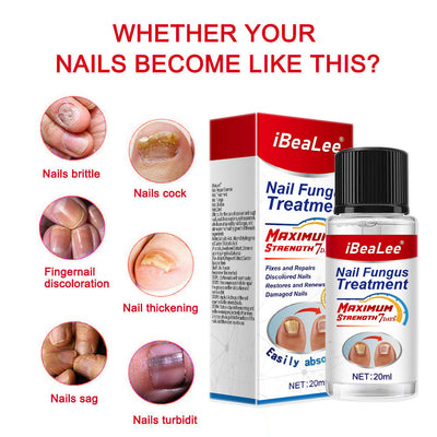 Thickening Of Special Bacteriostatic Liquid For Onychomycosis - 0 - CJ