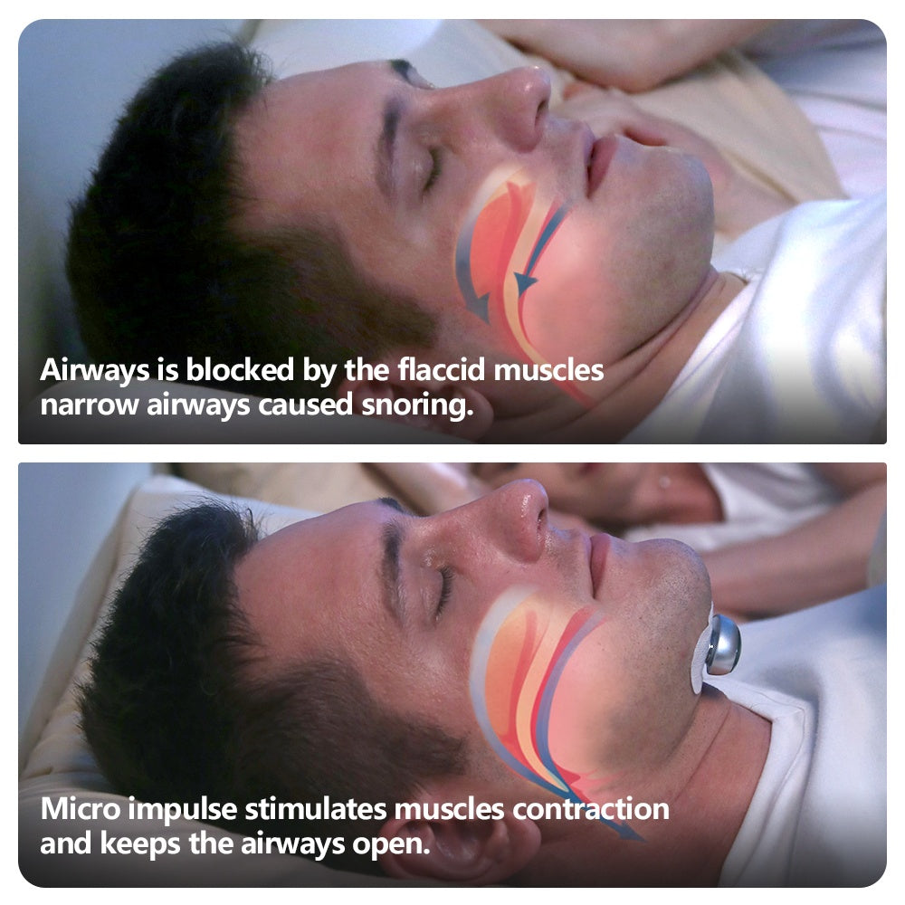 Smart Anti Snoring Device Electronic Muscle Stimulator Pro With 20pcs Conductive Strips - 5 - CJ