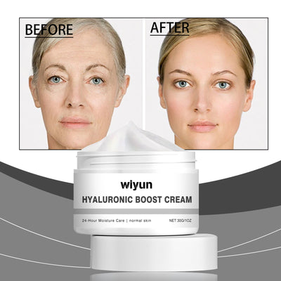 Wiyun Hyaluronic Acid Moisturizing Moisturizer, Improves Skin Elasticity And Moisturizes Skin Daily Care Cream - 5 - CJ