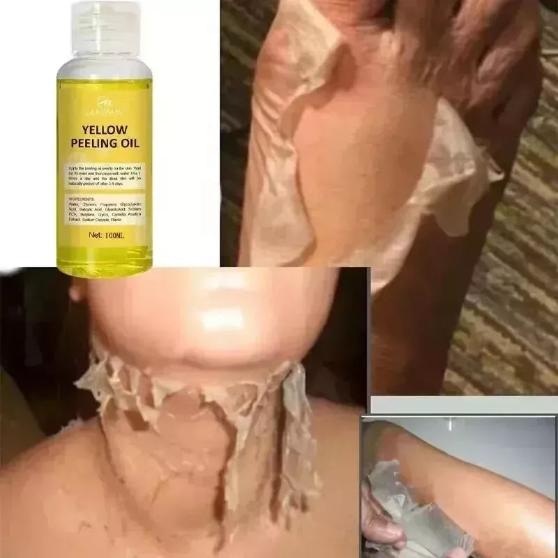 Exfoliating Butter Peeling Hydrating Moisturizing Fading Melanin Brightening - 0 - CJ