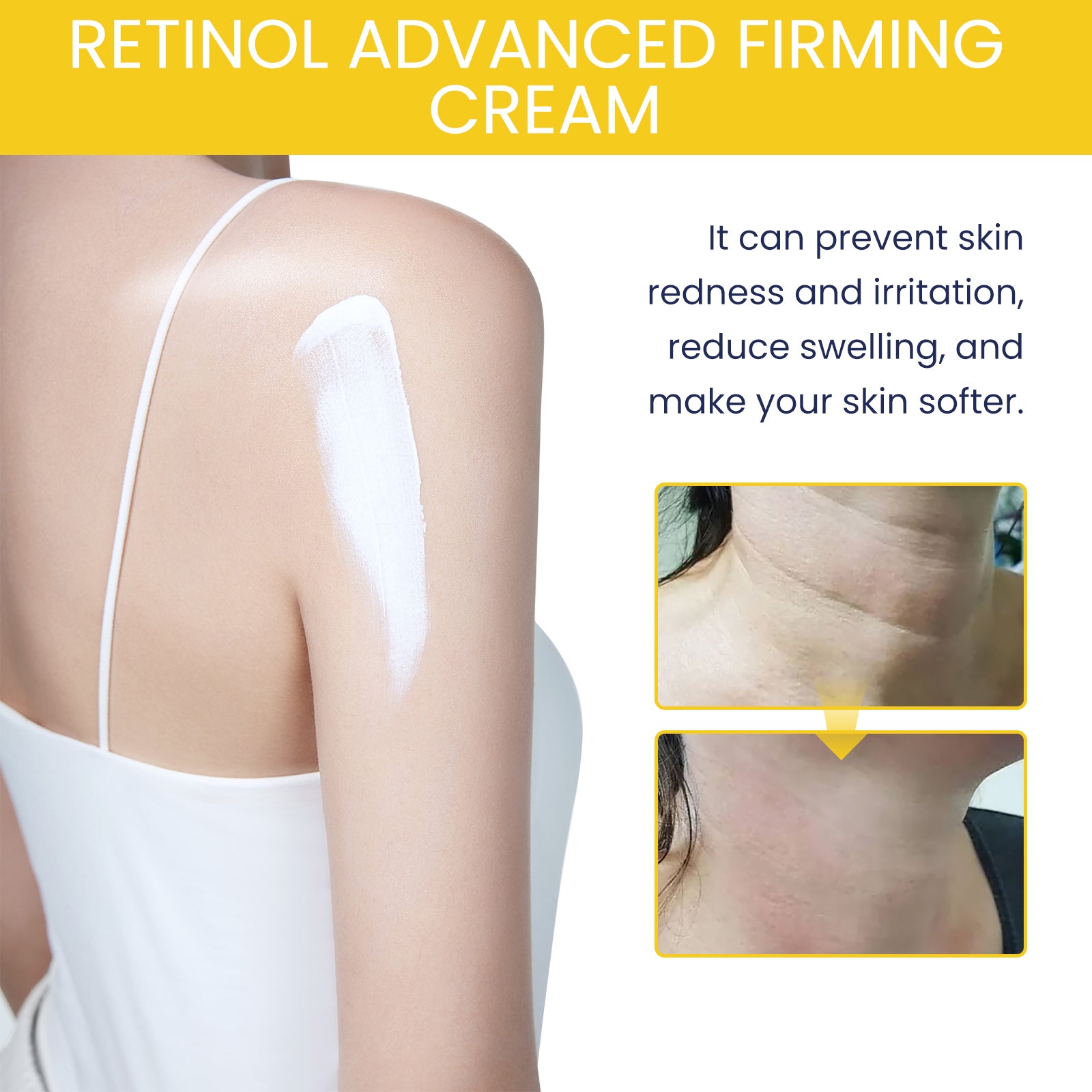 OceAura Retinol Advanced Firming Cream, Hydrating And Rejuvenating Brightening Body Smooth Anti - Wrinkle Body Lotion For Skin - 5 - CJ