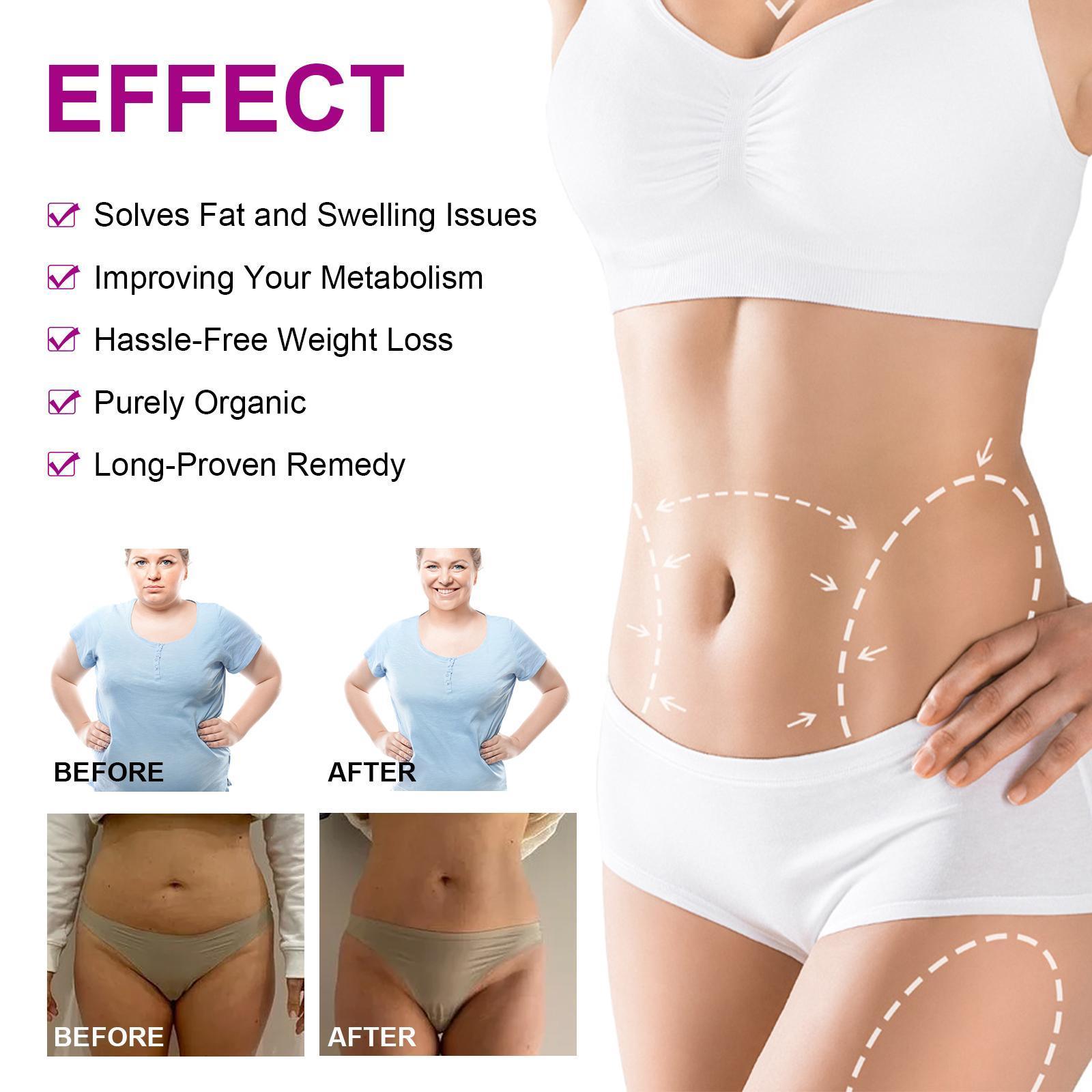 Yihe Abdomen Lifting Belt, Tightens Loose Skin And Reshapes Belly Button - 5 - CJ