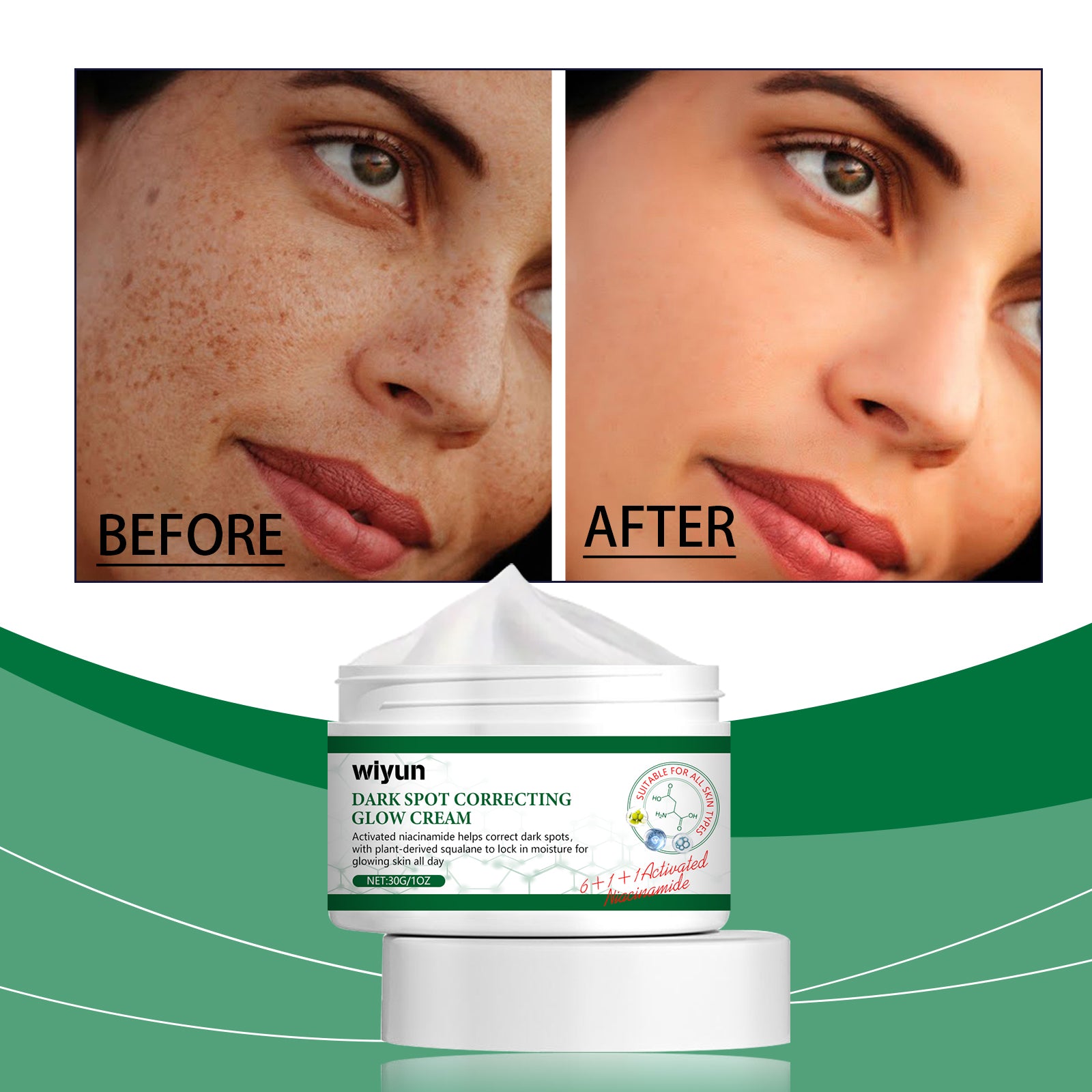 Wiyun Brightening Cream, Restores Dark Skin, Brightening, Moisturizing, Nourishing, Moisturizing, Rejuvenating And Beautifying Face Cream - 5 - CJ