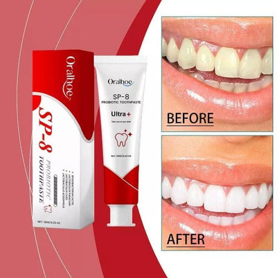 Oralhoe - Protective Toothpaste - 5 - CJ
