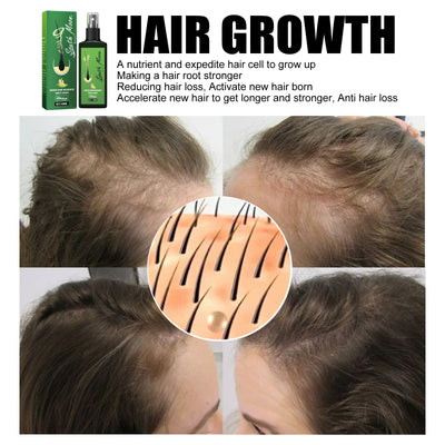 South Moon Hair Nourishing Spray Hair Strengthening Anti Hair Fall Hair Dense Hair Moisturizing Hydrating Scalp Conditioner - 5 - CJ