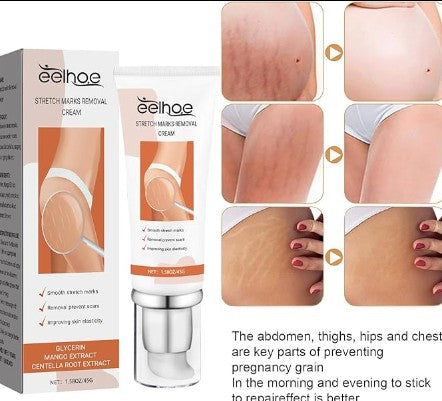 Eelhoe - Stretch Marks Removal Cream - 5 - CJ