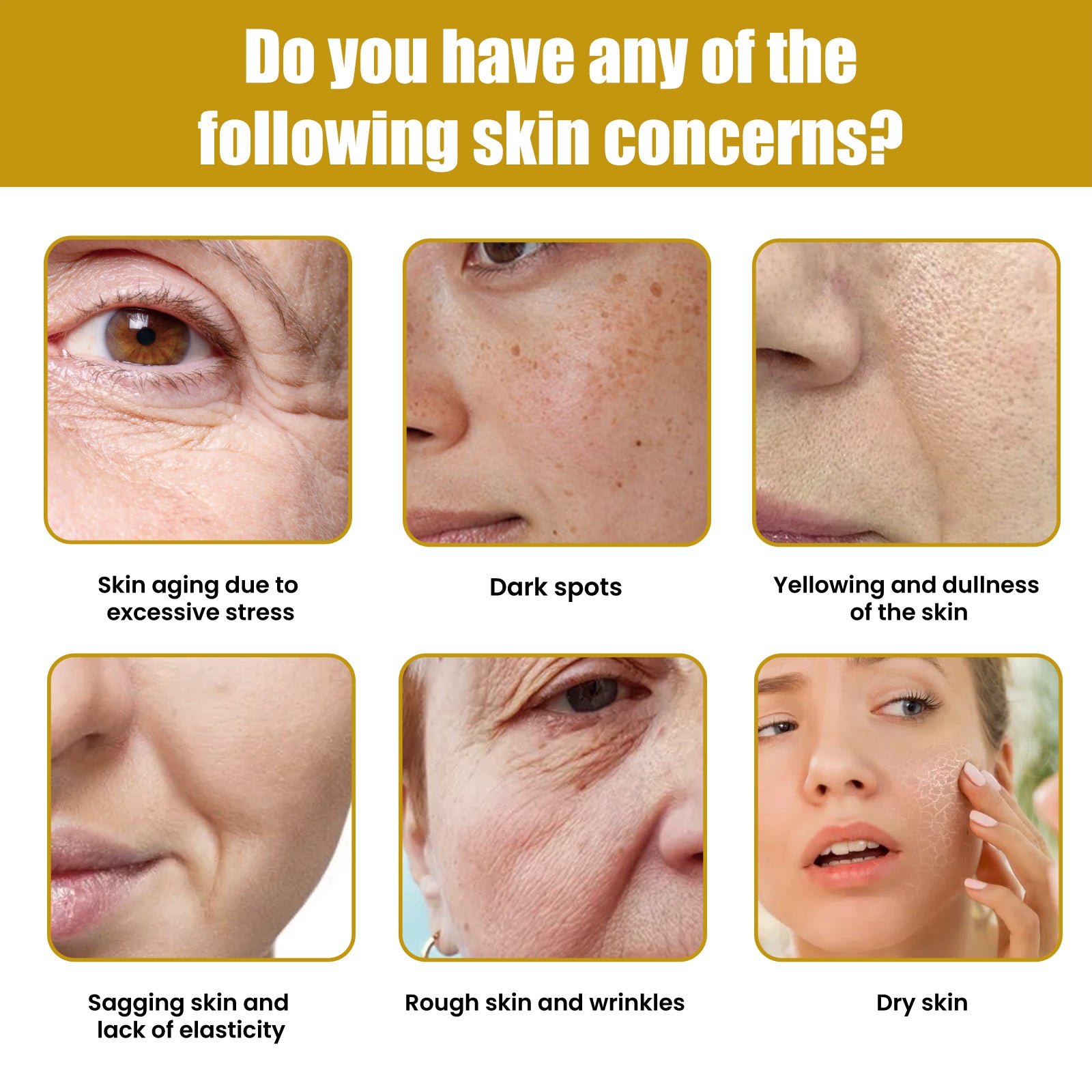 Hoygi Krema Za Lice S Pčelinjim Otrovom, Fade Out Fine Lines Wrinkles Hydrating Moist Firming Skin Bright Skin Anti - Wrinkle Cream - 5 - CJ