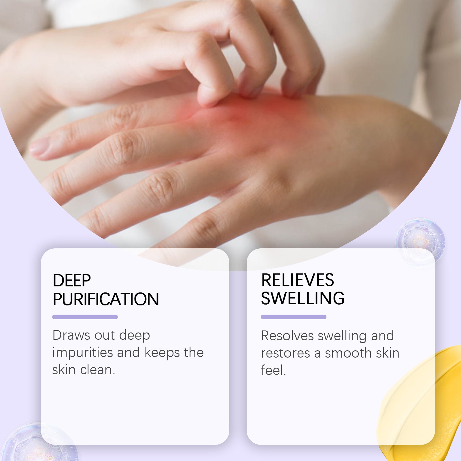 Houkea Propolis Body Care Cream, Nourishes Skin Care For Discomfort Gently Apply Skin Body Care Cream - 5 - CJ