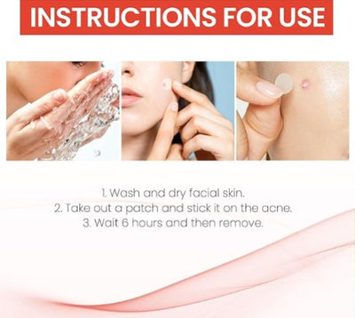 Acne Cover Patch - 5 - CJ