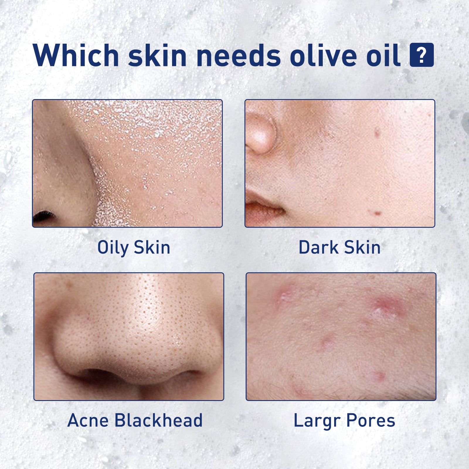 West&Month Exfoliating Mousse, Cleanser Skin Pore Control Oil Gently Cleanses Exfoliating Dead Blackheads - 5 - CJ