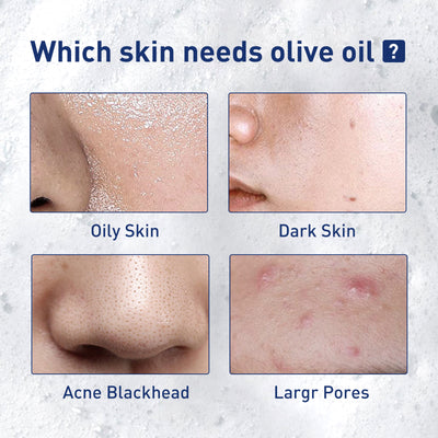West&Month Exfoliating Mousse, Cleanser Skin Pore Control Oil Gently Cleanses Exfoliating Dead Blackheads - 5 - CJ
