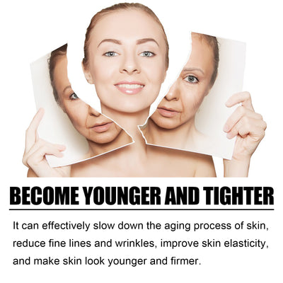 OUHOE TCA Acid Skin Peel Serum - 5 - CJ