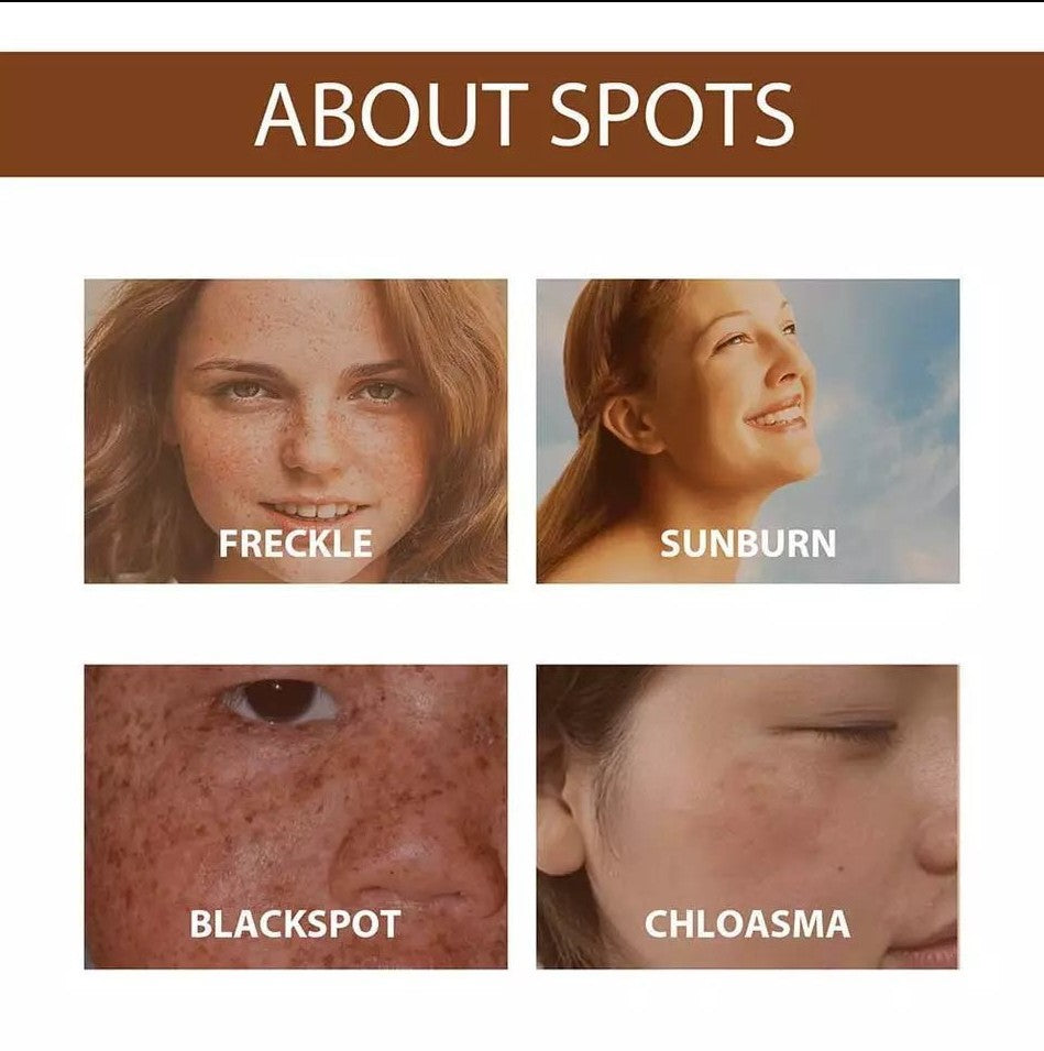 Anti Freckle Serum - 5 - CJ
