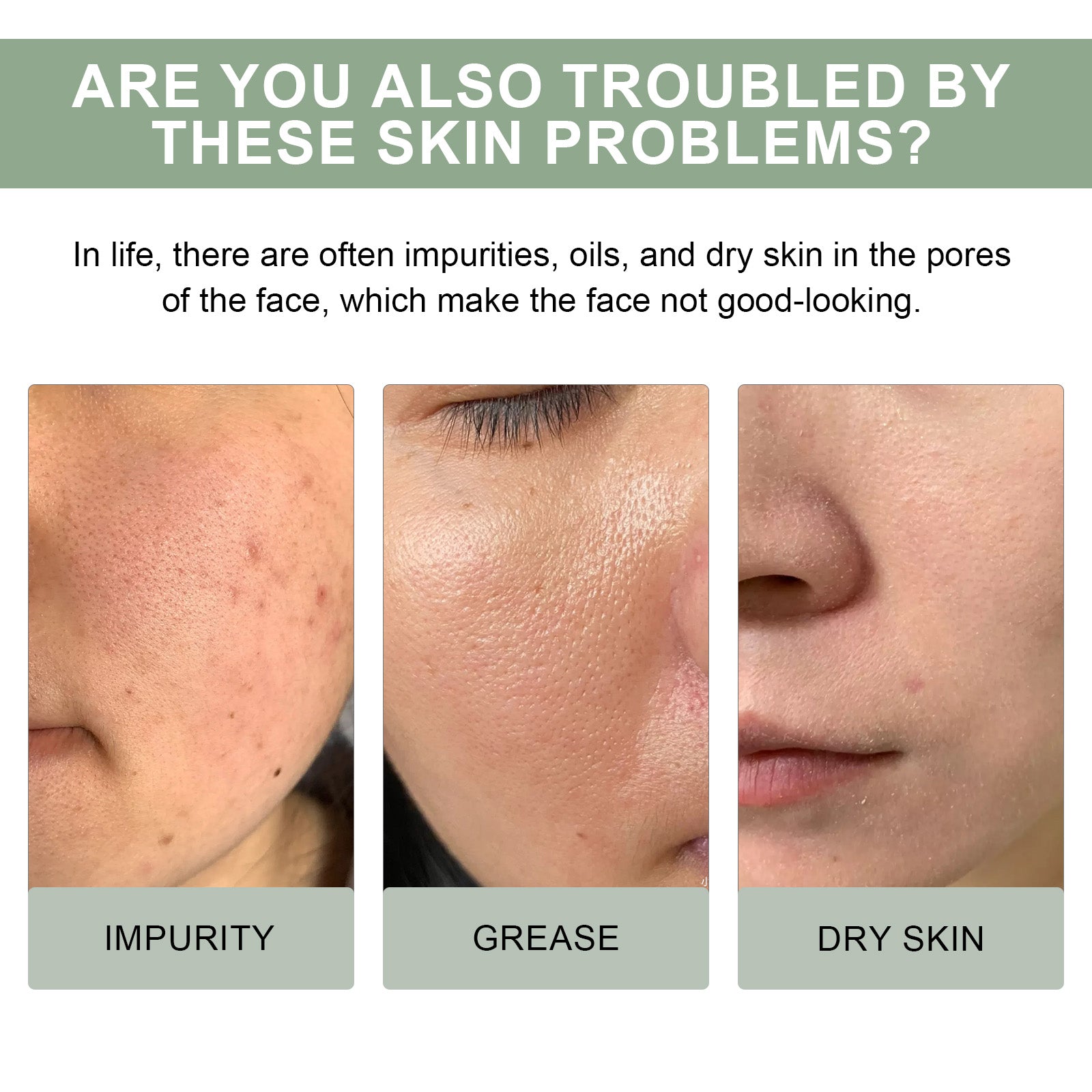 Hoygi Pore Deep Cleansing Foam, Deep Clean Facial Skin Shine Bright Moist Blain To Imprint Clear Water - 5 - CJ