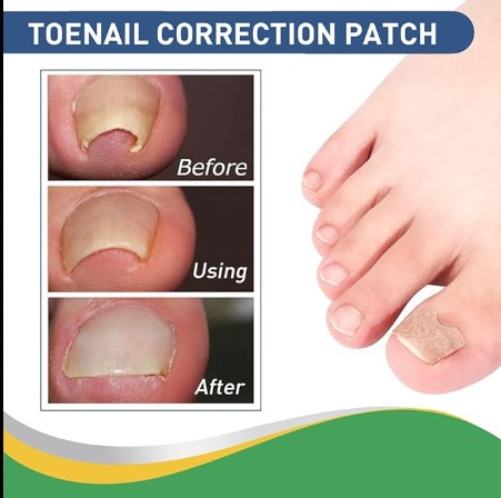 Hanel - Pain Relief Patch - 5 - CJ