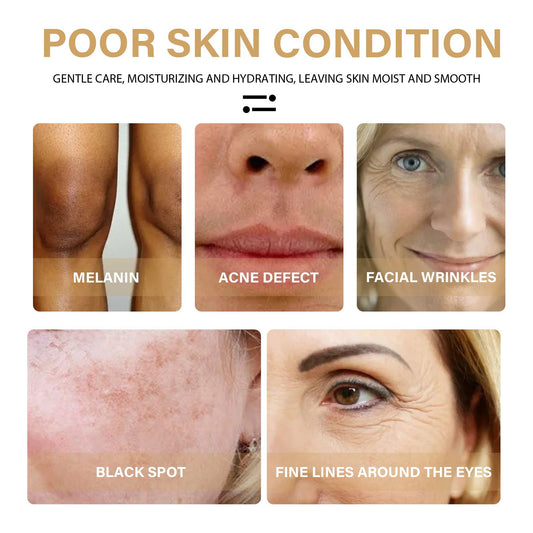 EELHOE Turmeric Dark Spot Correcting Serum Face Care Spot Moisturizing Nourishing Repairing Complexion Serum - 5 - CJ