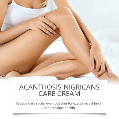 Wiyun Acanthoderma Nigricans Care Cream Soft Moist, Hydrating, Refreshing And Improving Dry And Tender Skin Body Care Cream - 5 - CJ