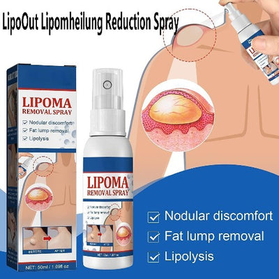 South Moon - Lipoma Removal Spray - 5 - CJ