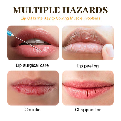EELHOE Honey Lip Oil, Reduces Lip Lines, Prevents Cracking And Peeling, Moisturizing Lip Care Oil. - 5.0 - CJ