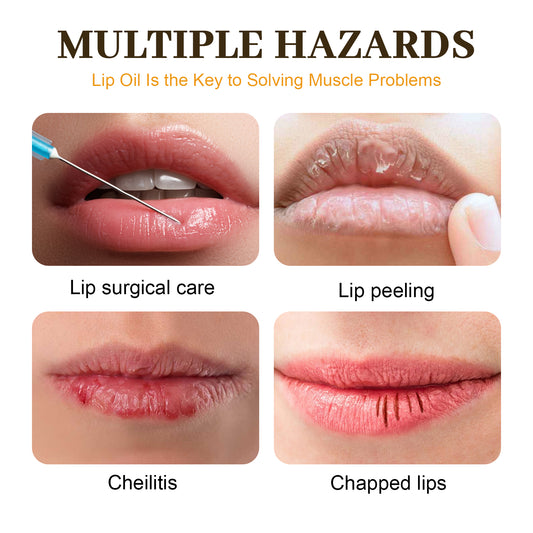 EELHOE Honey Lip Oil, Reduces Lip Lines, Prevents Cracking And Peeling, Moisturizing Lip Care Oil. - 5.0 - CJ