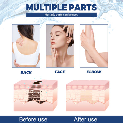 Jaysuing Spot Body Cleanser, Face Body Cleansing Skin Fade Spot Whitening Beauty Skin Cream - 5 - CJ