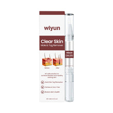 Wart Removing Pen Liquid - 0 - CJ