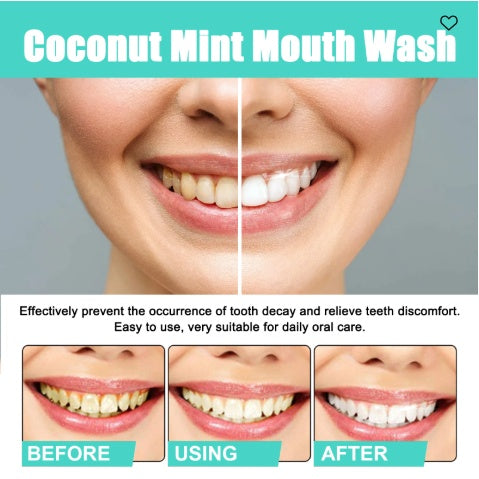 Oralhoe Coconut Mint Mouth Wash, Whitening Teeth Yellow Teeth Stains Tongue Coating Clean  Breath Oral Care - 5 - CJ